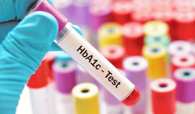 Cách thử tiểu đường tại nhà bằng xét nghiệm HbA1c